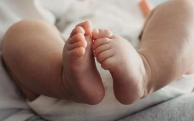Circumcision in Newborns